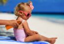 Prevención y tratamiento de quemaduras de sol en niños